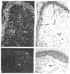 Expression Image