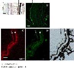Expression Image