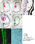 Expression Image