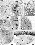 Expression Image