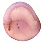Expression Image