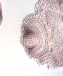 Expression Image