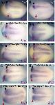 Expression Image