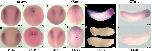 Expression Image