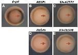 Expression Image